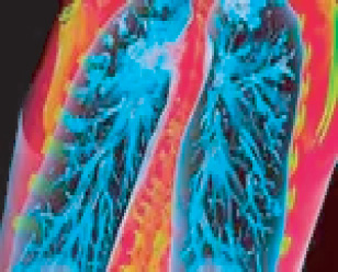 ফুসফুসের রোগে যারা ভুগছেন তারা কী করবেন?